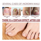 Nail Oil ১ পিছ